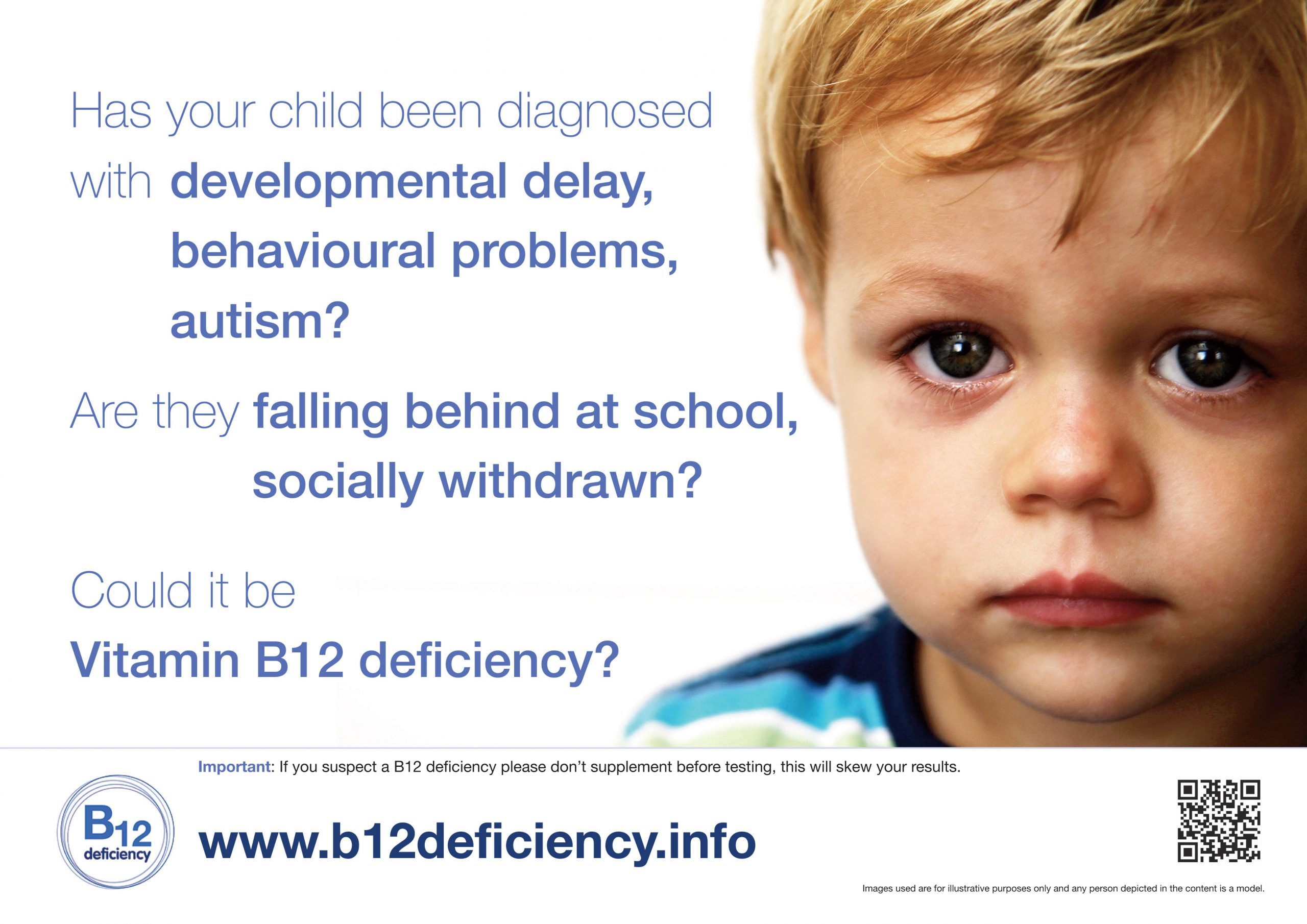 The Ignorance of Vitamin B12 Deficiency in Children